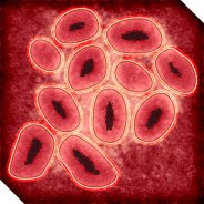 雾霾病毒 — Plague Inc: Evolved Workshop preview